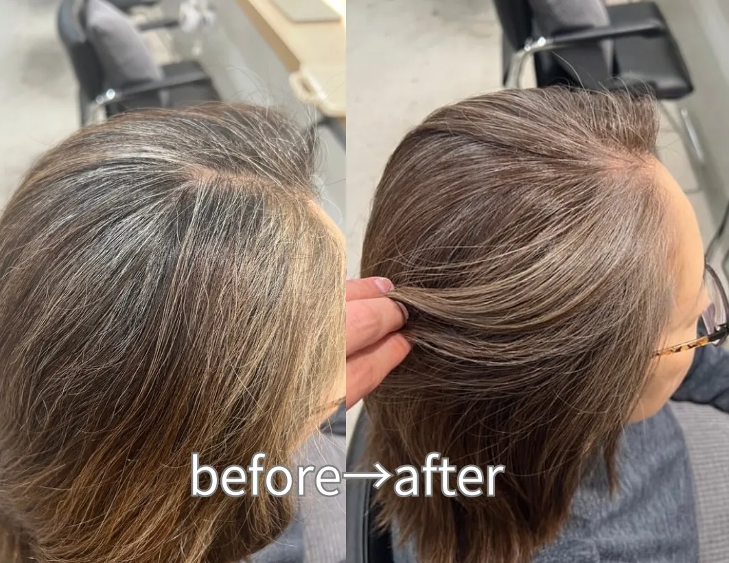 気になる白髪の位置は？